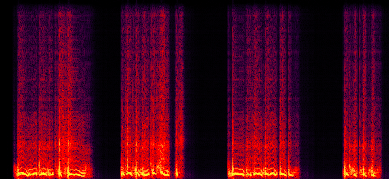 Prosody Visualization