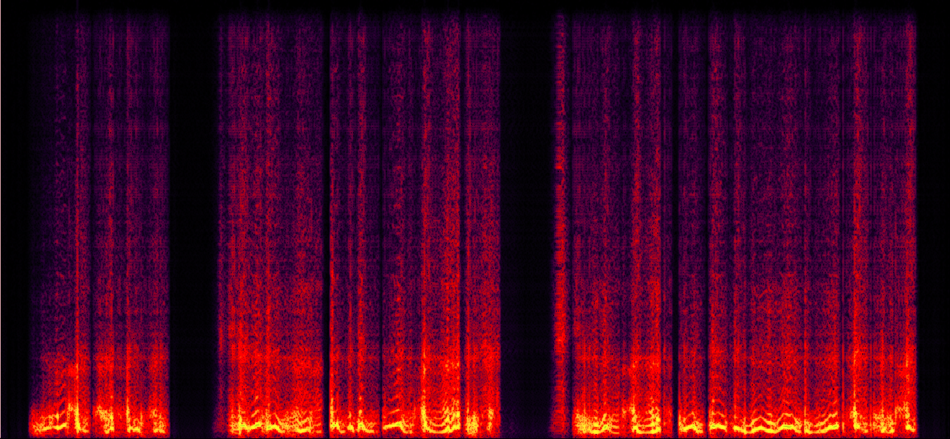 Prosody Visualization