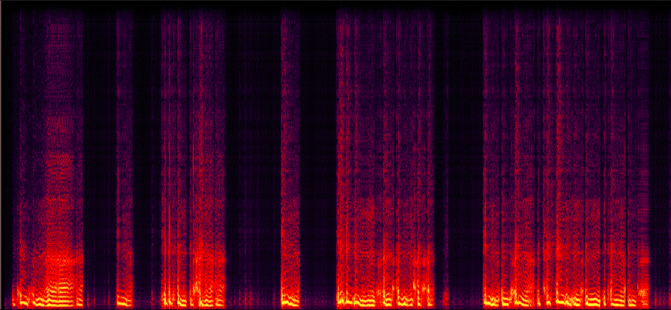 Prosody Visualization
